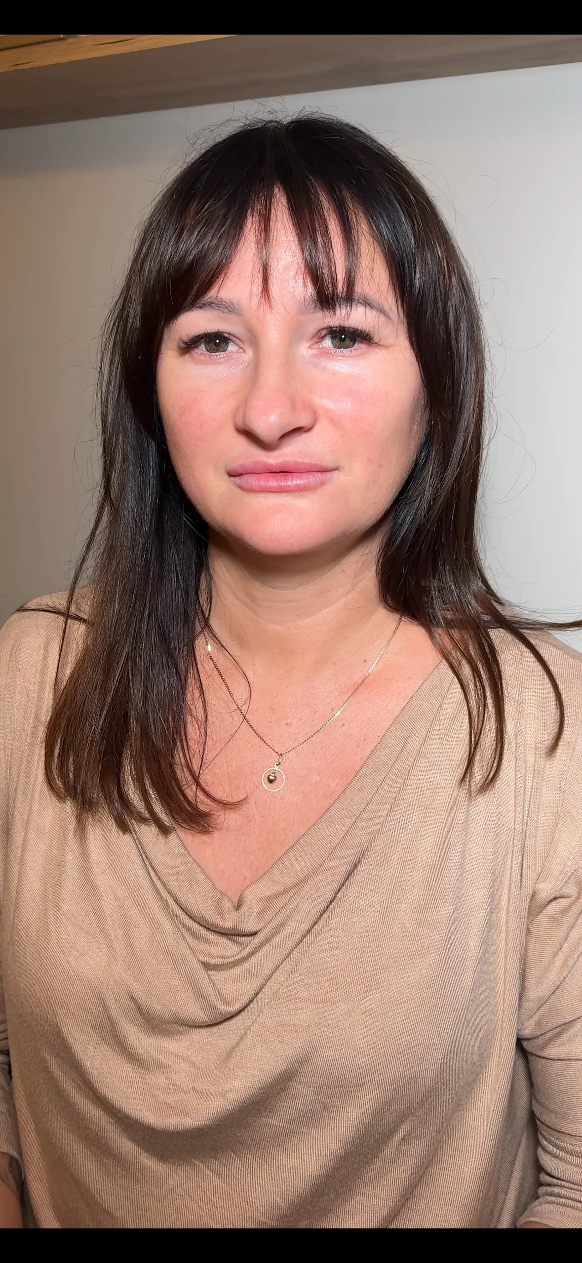 Cera naczynkowa zaczerwienienia twarzy Sopot